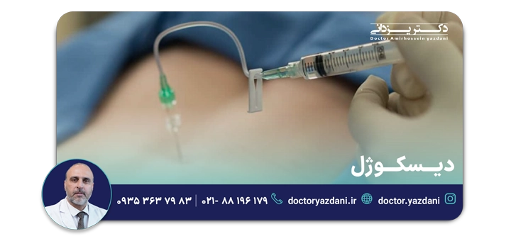 دیسکوژل
